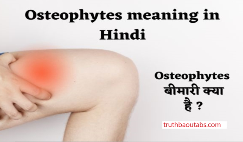 Osteophytes meaning in Hindi अर्थ, मतलब और परिभाषा