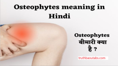 Osteophytes meaning in Hindi अर्थ, मतलब और परिभाषा