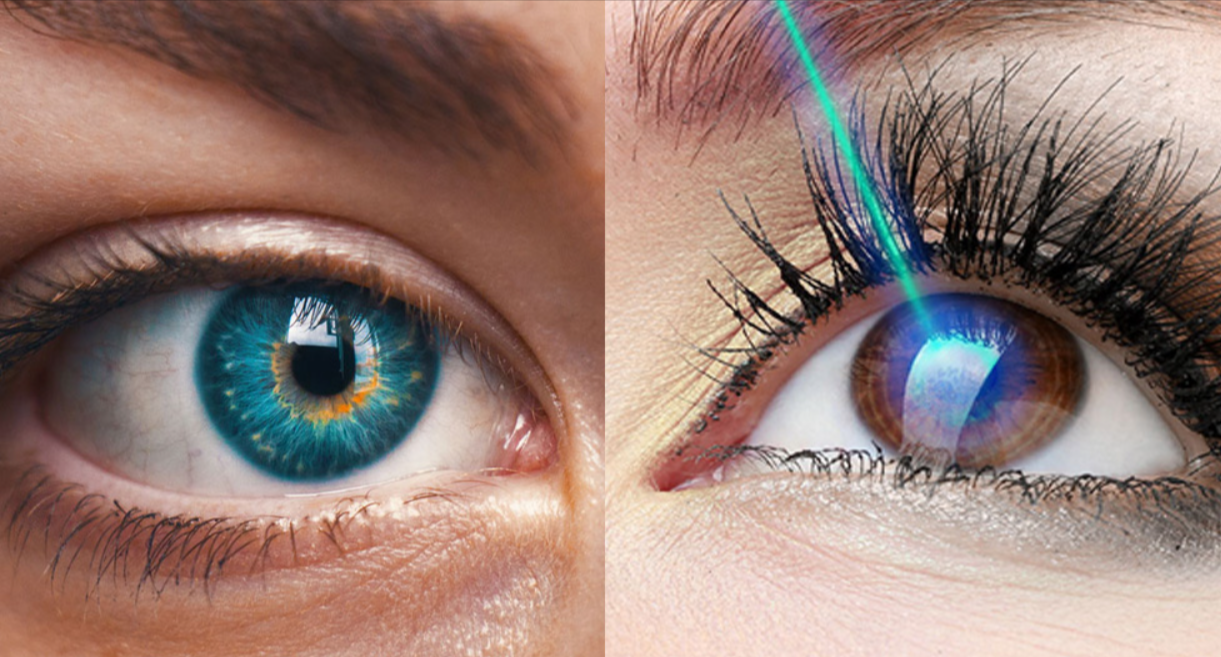 Modern Vision Care