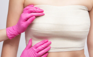 Breast Surgeon in Dubai