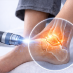Guide to Ligament Issues Treatment in Dubai